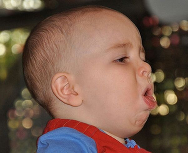 Những điều cần biết khi trị ho sổ mũi cho bé